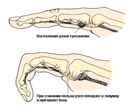 Что находится в пальцах рук?