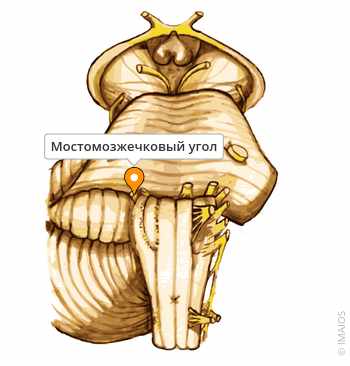 Что такое мостомозжечковый угол?