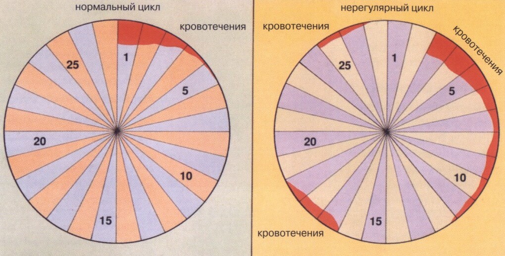 Что такое нарушение менструального цикла?