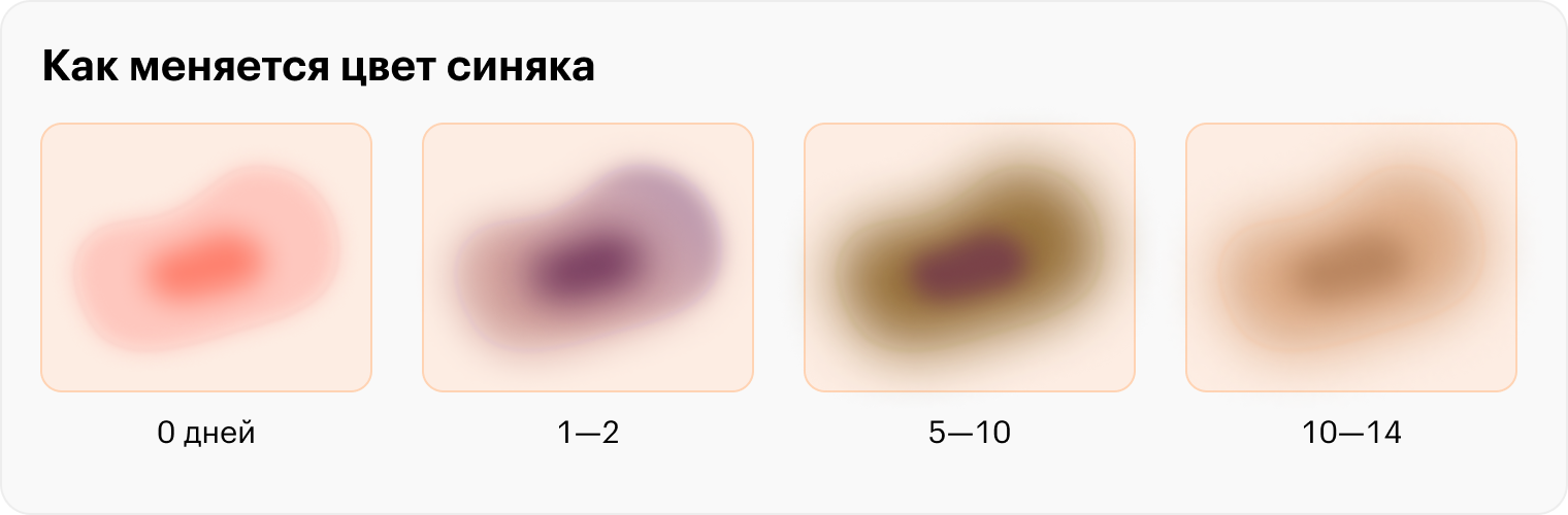 Как долго появляются синяки?