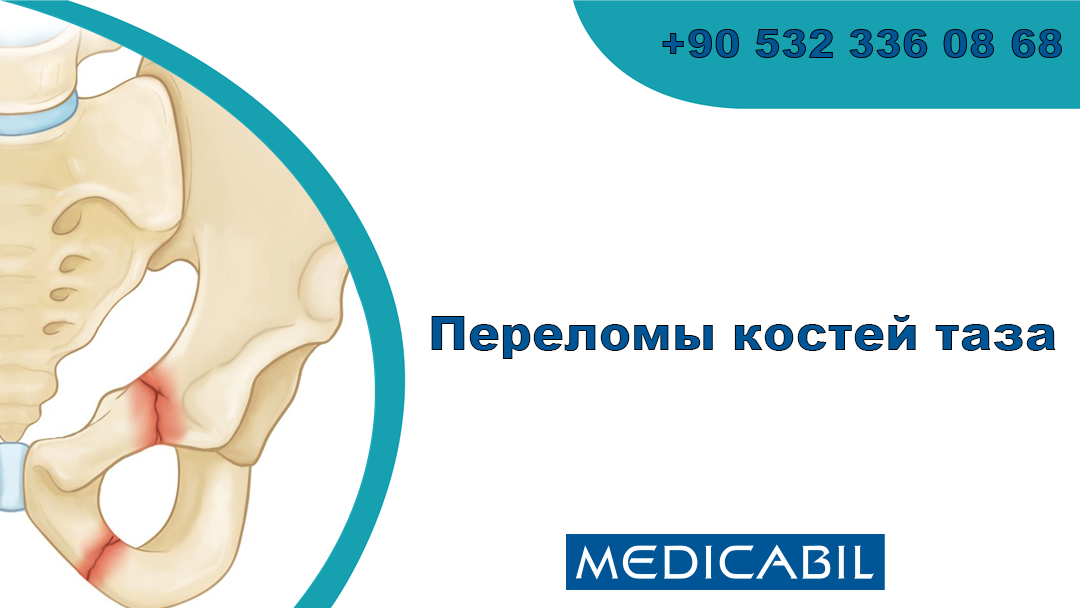 Как можно сломать кости таза?