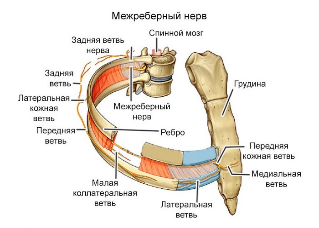 Как можно вылечить межреберную невралгию?