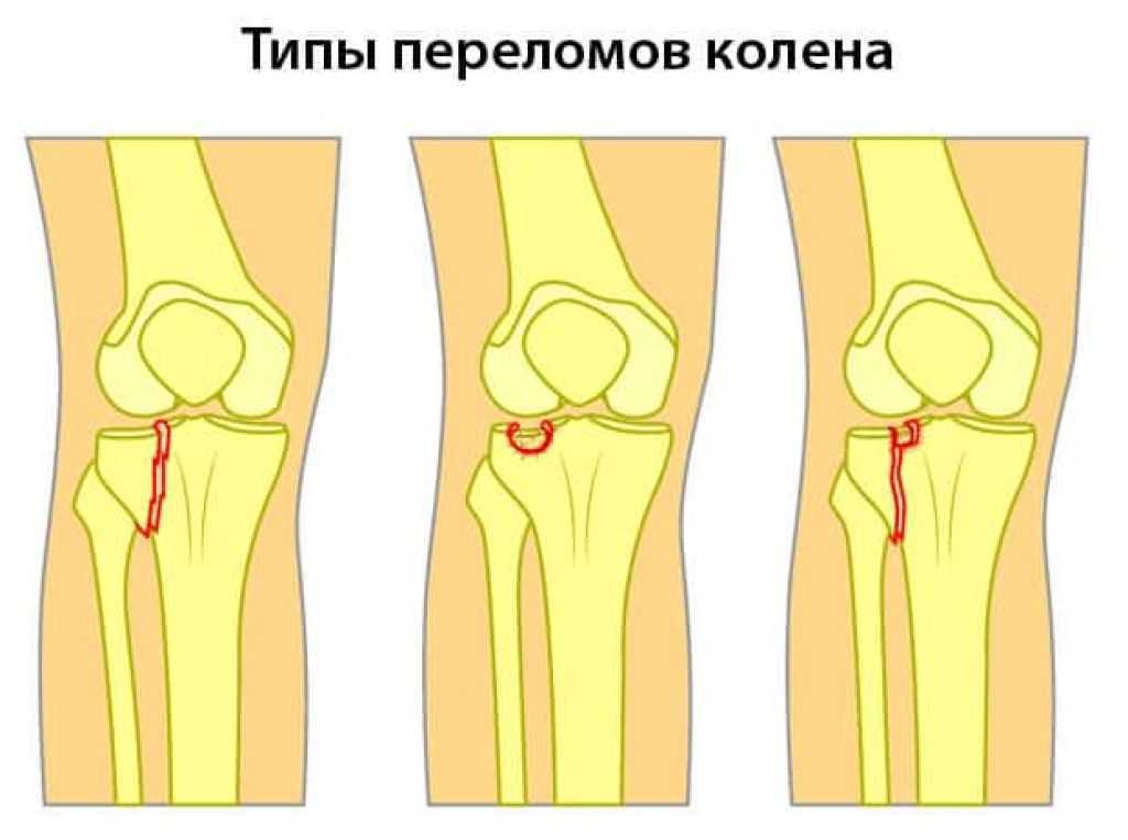 Как определить перелом позвоночника у собаки?