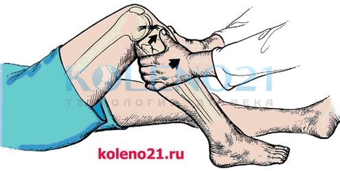 Как проверить крестообразную связку?