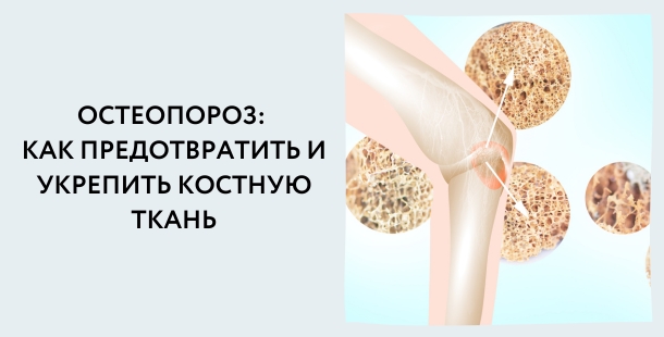 Как укрепить костную ткань?
