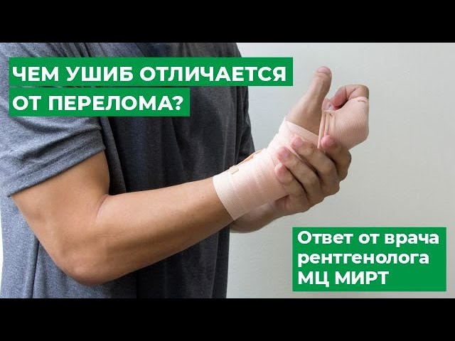 Как узнать сломана кисть руки или нет?