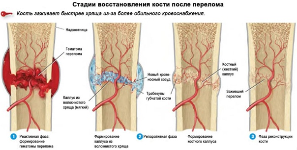 Как заживает перелом кости?