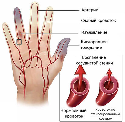 Какие болезни вызывает вредная пища?
