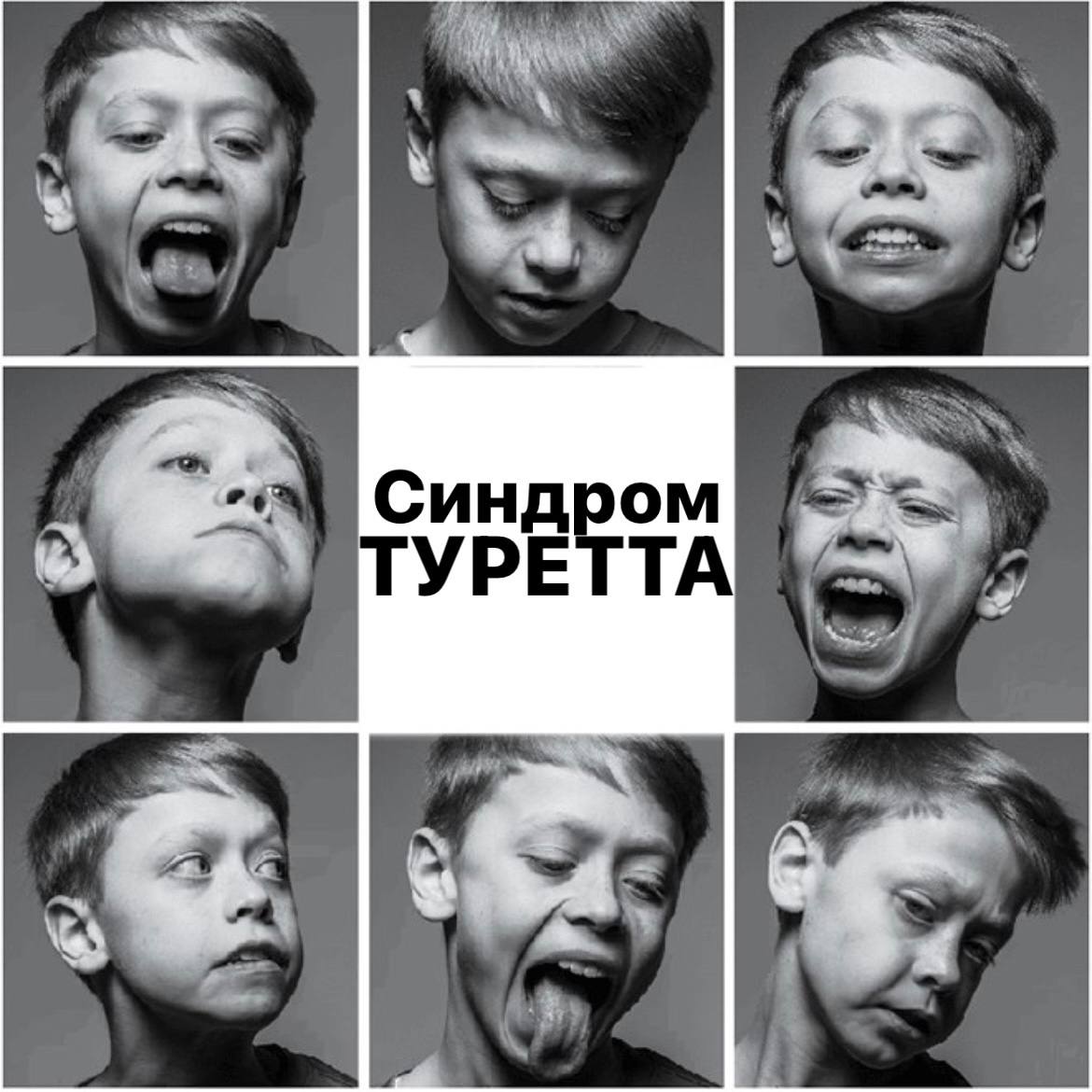 Какие бывают синдромы у людей?