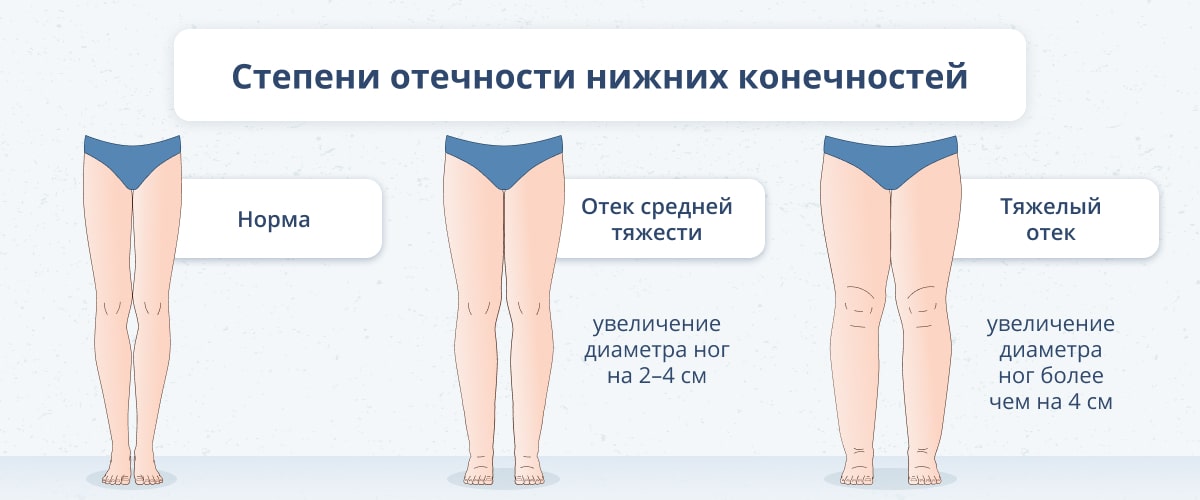 Какие препараты снимают отечность?