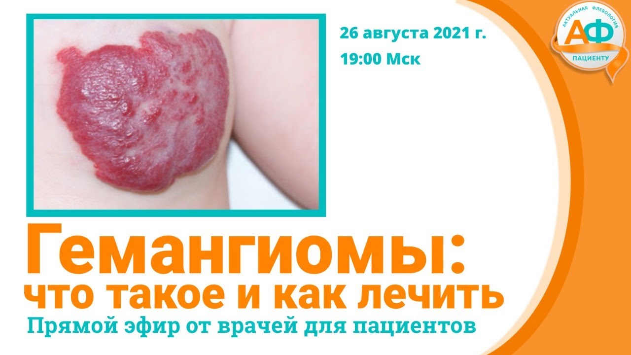Какие врачи лечат гемангиомы?