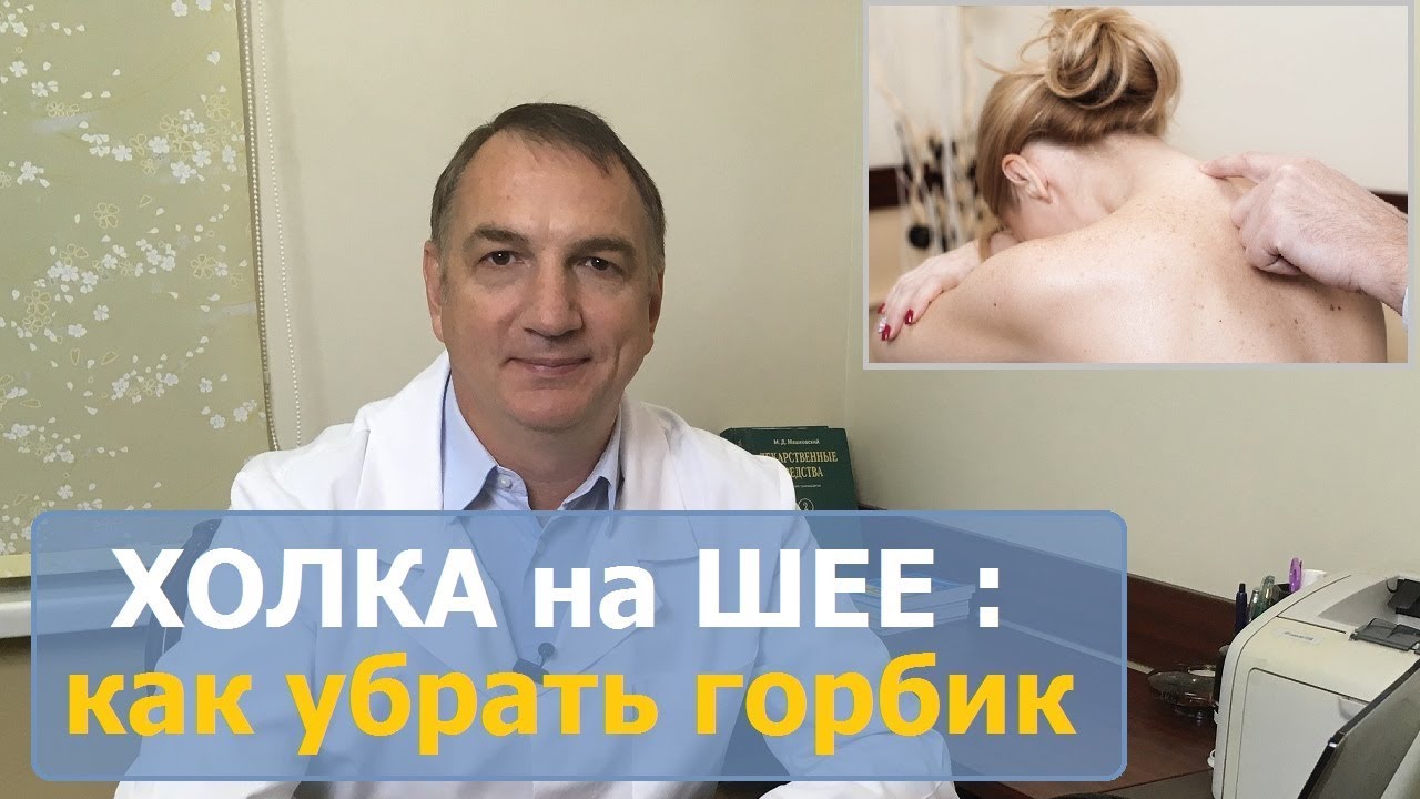 Почему растет холка на шее?