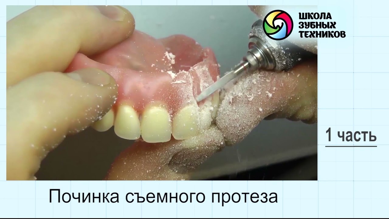 Сколько стоит починка экрана айфона?